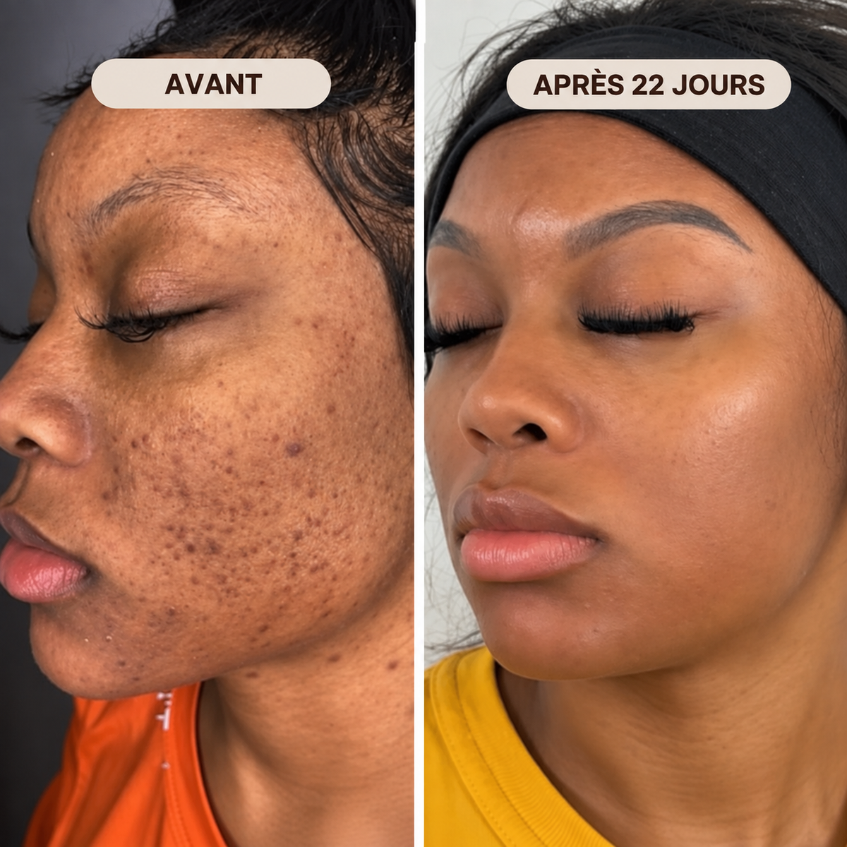 Exfoliant Purifiant